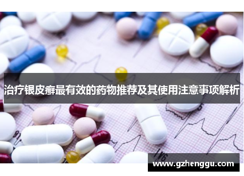 治疗银皮癣最有效的药物推荐及其使用注意事项解析